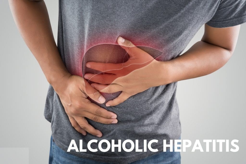 What You Should Know About Alcoholic Hepatitis The Freedom Center